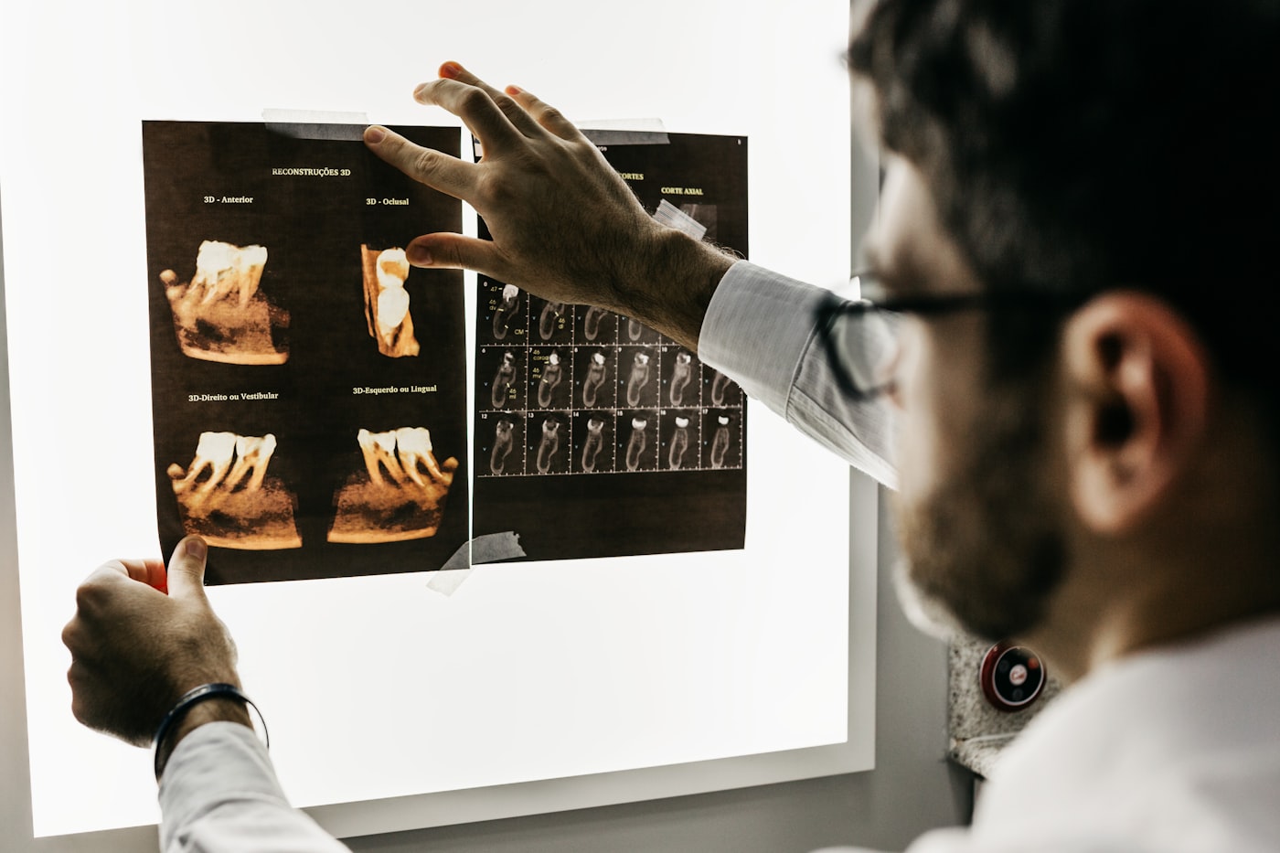 3D implant planning at Lumi Dental